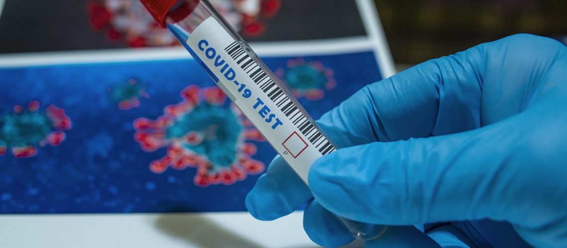 covid-19, coronavirus, quarantine
